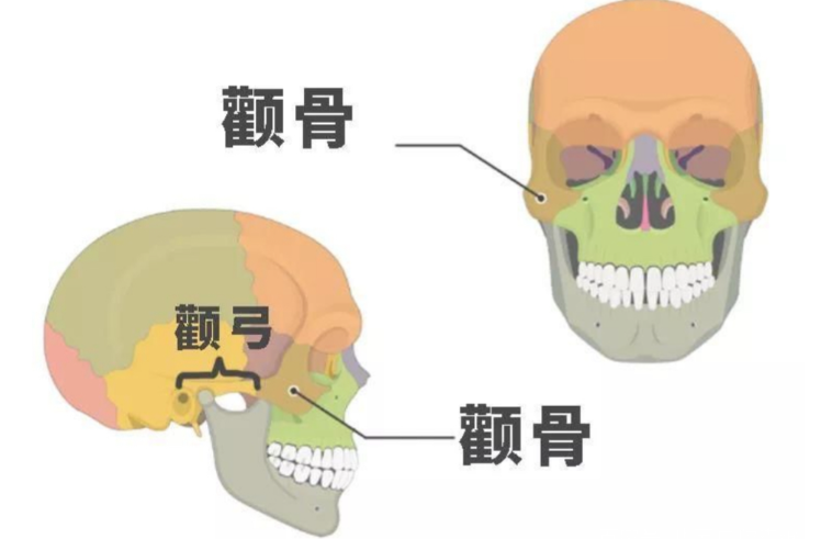 韓國宋昌奉顴骨內(nèi)推怎么做的