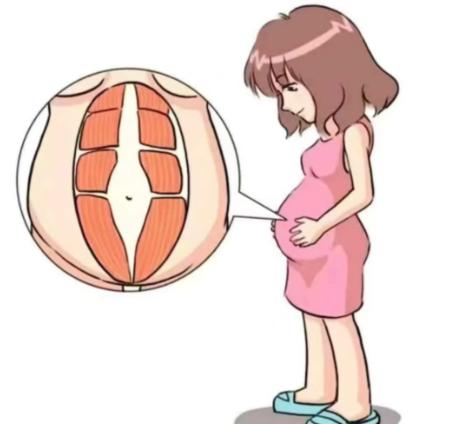 徐禮亮腹壁整形口碑咋樣？