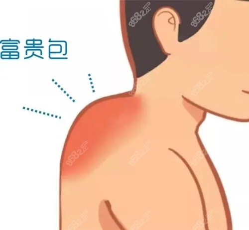 富貴包示意圖 富貴包示意圖