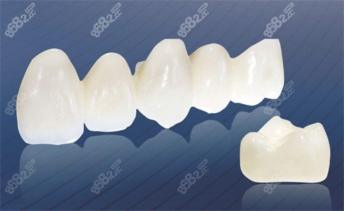 全瓷牙 全瓷牙