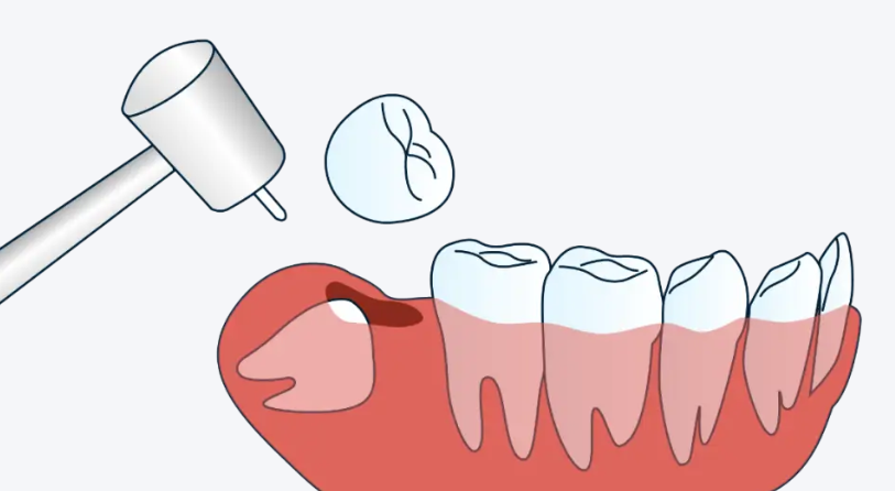 深圳崗廈麥芽口腔地址及交通指南