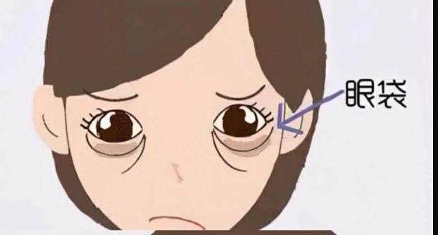 找北京王博謙祛眼袋注意事項