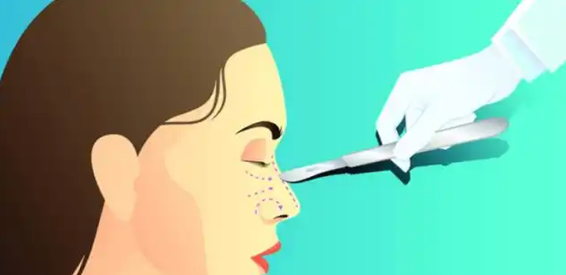 蘇州陳柳藝鼻修復(fù)組合項目收費參考