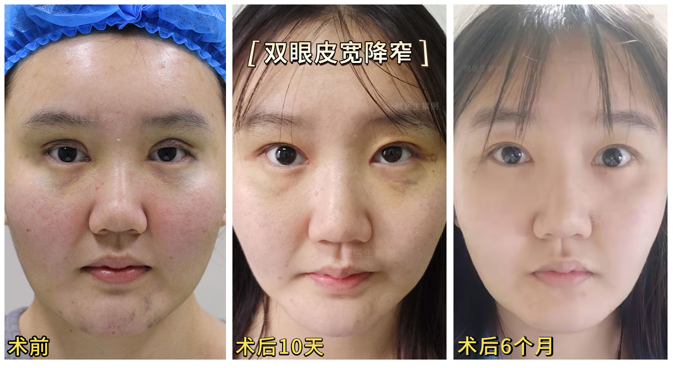 北京常冬青醫(yī)生雙改單特色