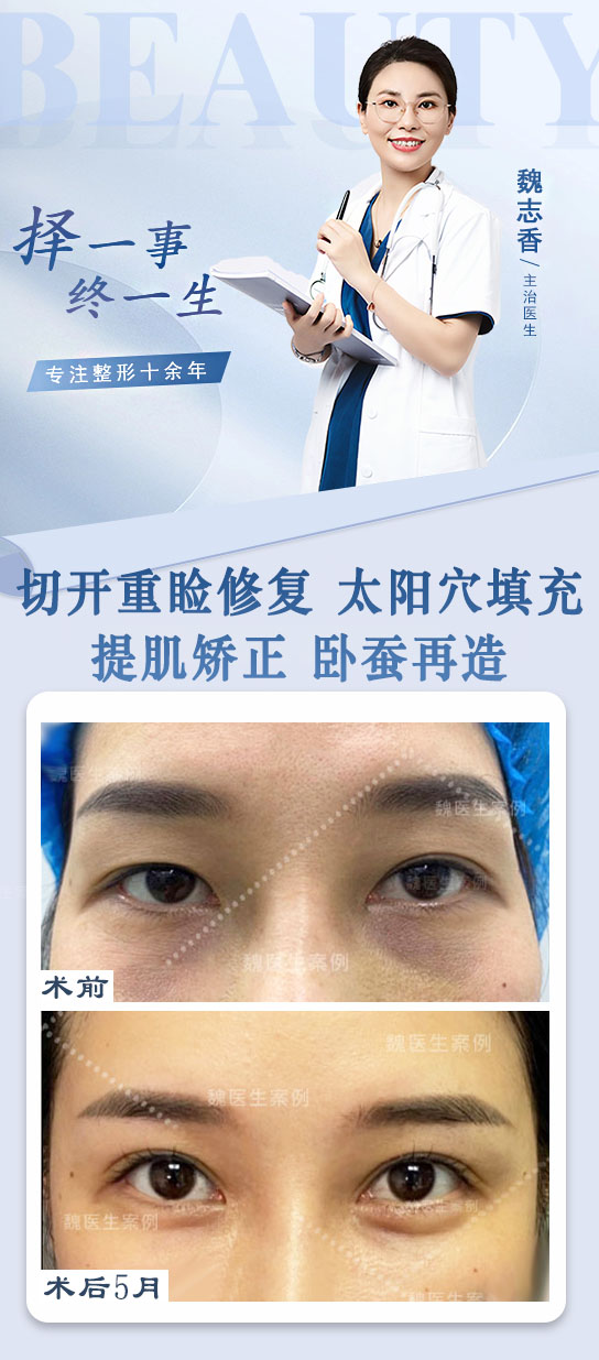 魏志香醫(yī)生雙改單高難度技術(shù)www.66ub.cn