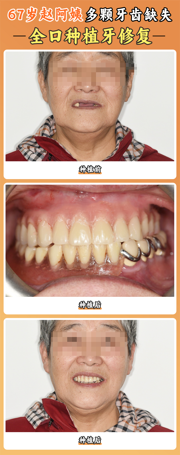 綜合實(shí)力強(qiáng)勁的劉宏濤醫(yī)生