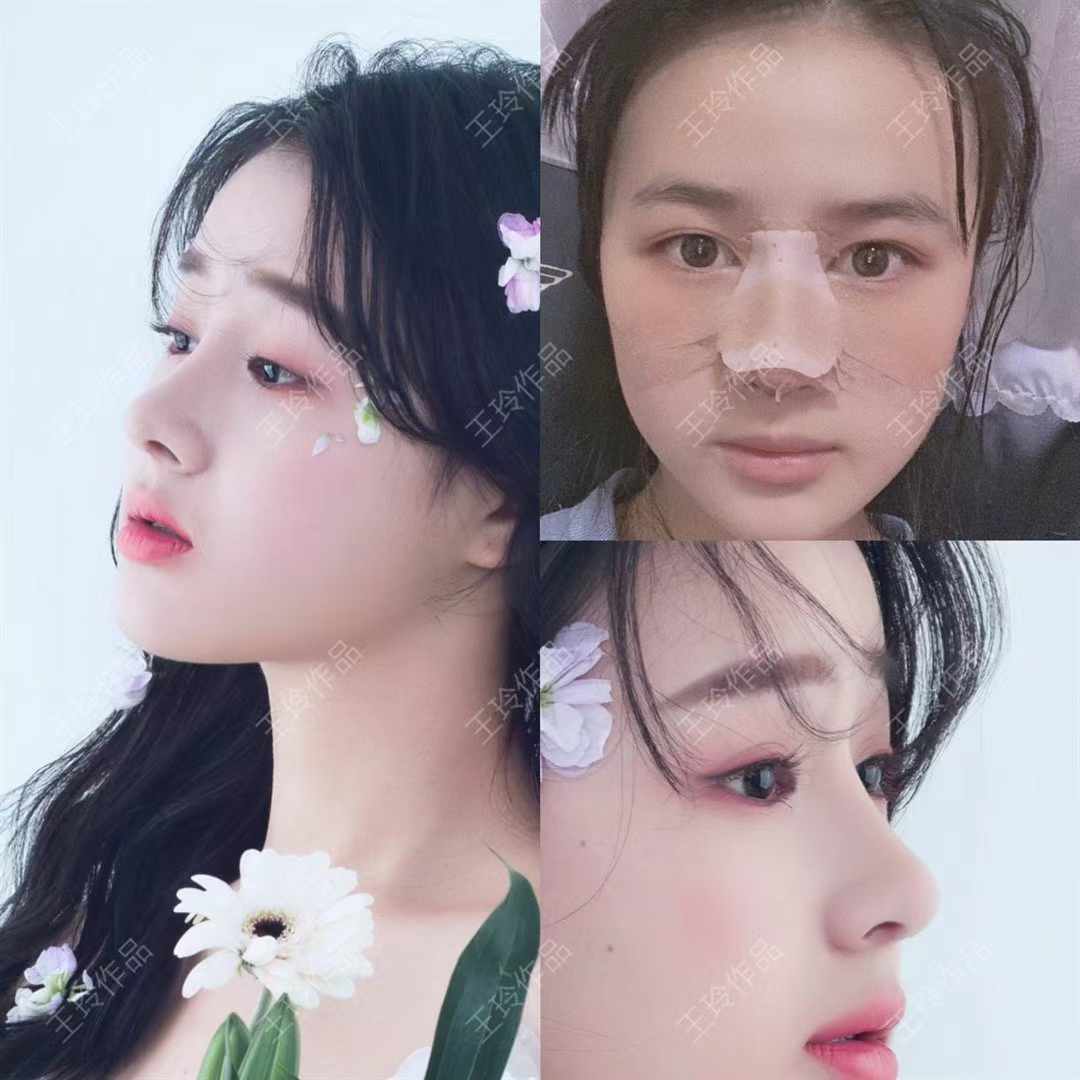 三、戴傳昌鼻綜合價格差異的“三大關(guān)鍵原因”