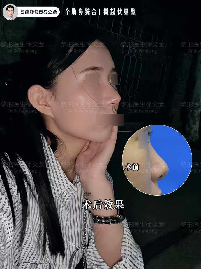 五、戴傳昌鼻綜合多少錢？理性看待“價格與價值”的平衡
