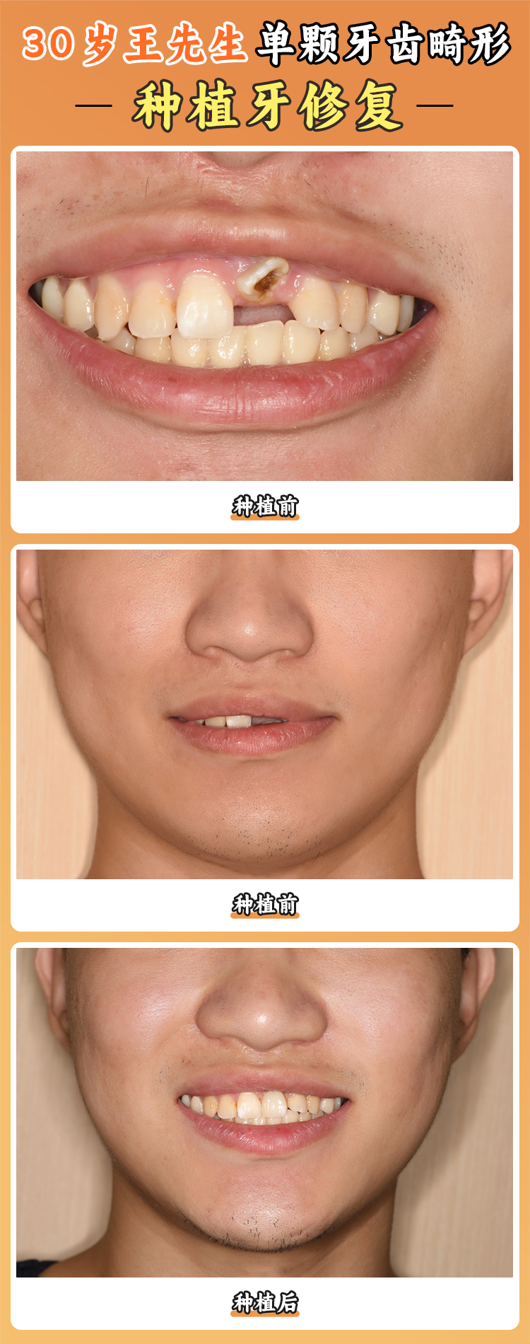 濮陽市人民醫(yī)院的骨干醫(yī)生李曉聰和劉慶坤www.66ub.cn