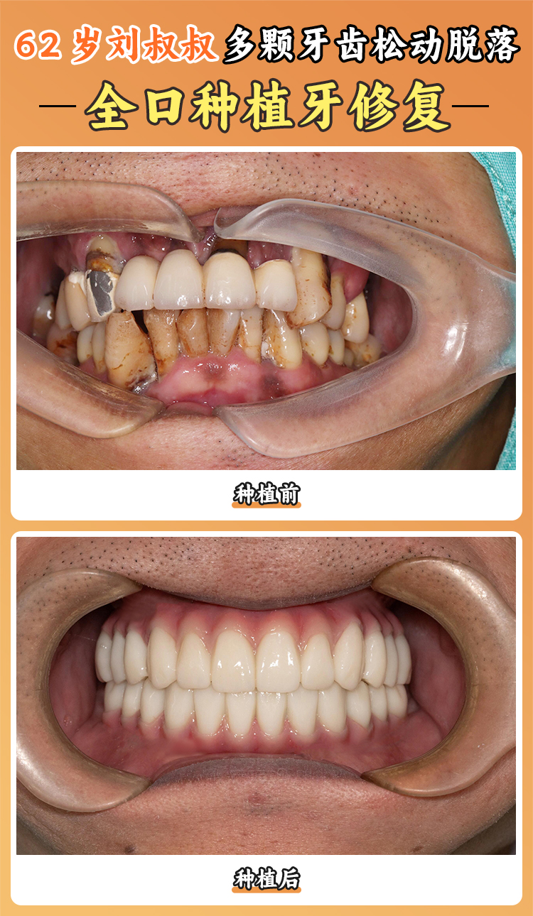 備受患者喜愛的韓亞超醫(yī)生