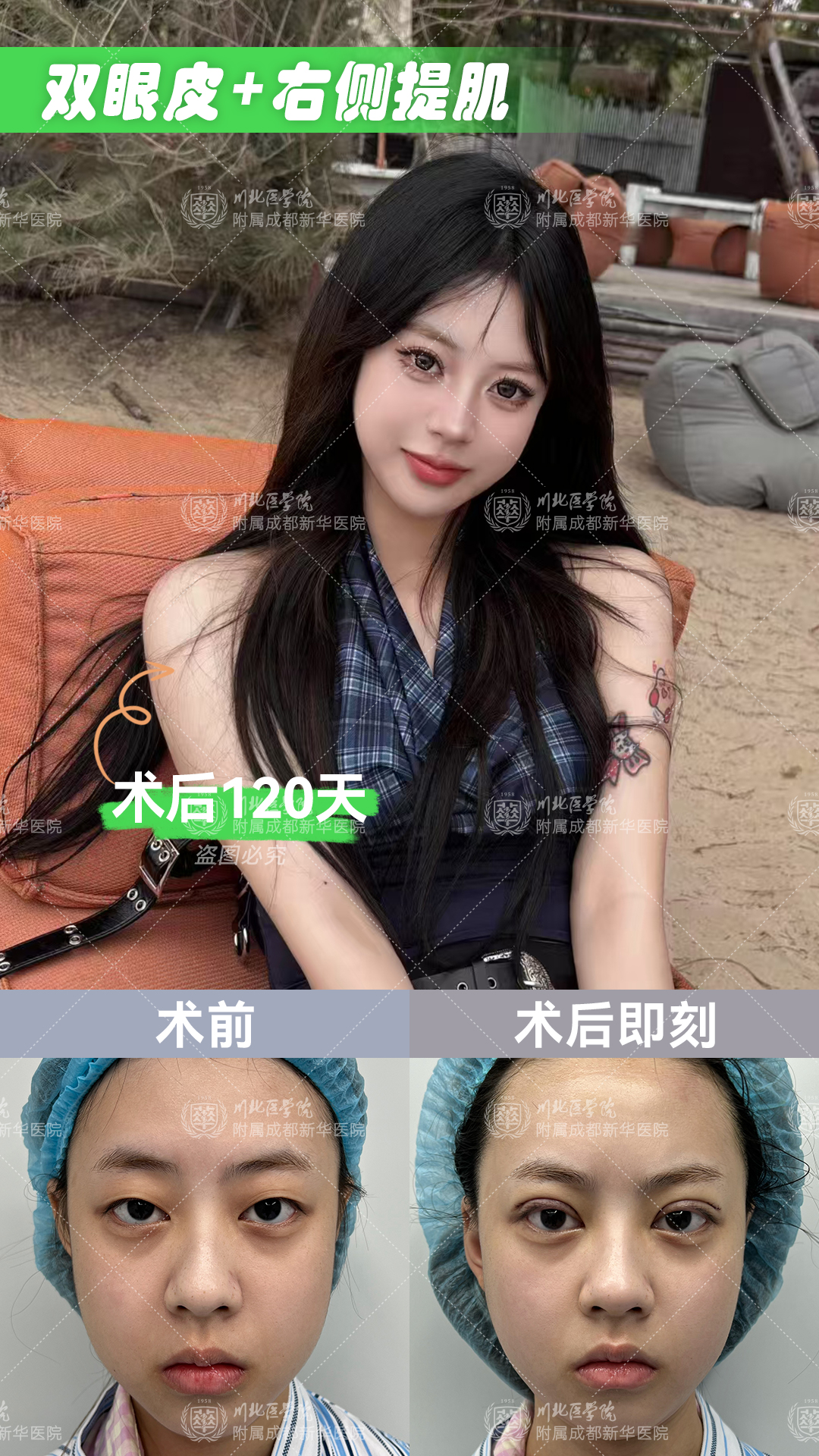 探索四平王清純醫(yī)療美容診所的便捷地址與交通路線指南，火車站對(duì)面交通便利，全切雙眼皮僅4200元起