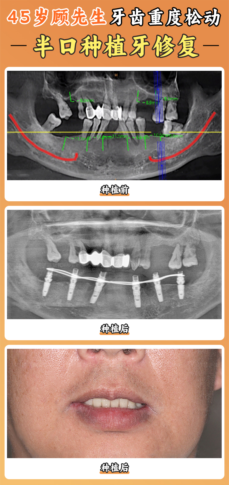 鹽城倍美口腔在牙齒矯正和鑲牙方面有哪些項(xiàng)目和價(jià)格？