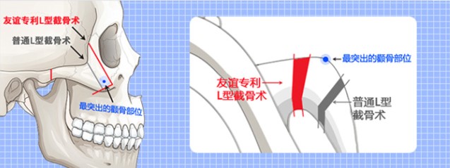 濟(jì)寧梁山程芳芳醫(yī)療美容口碑如何，專業(yè)團(tuán)隊(duì)+高性價(jià)比項(xiàng)目，顧客真實(shí)反饋大公開！