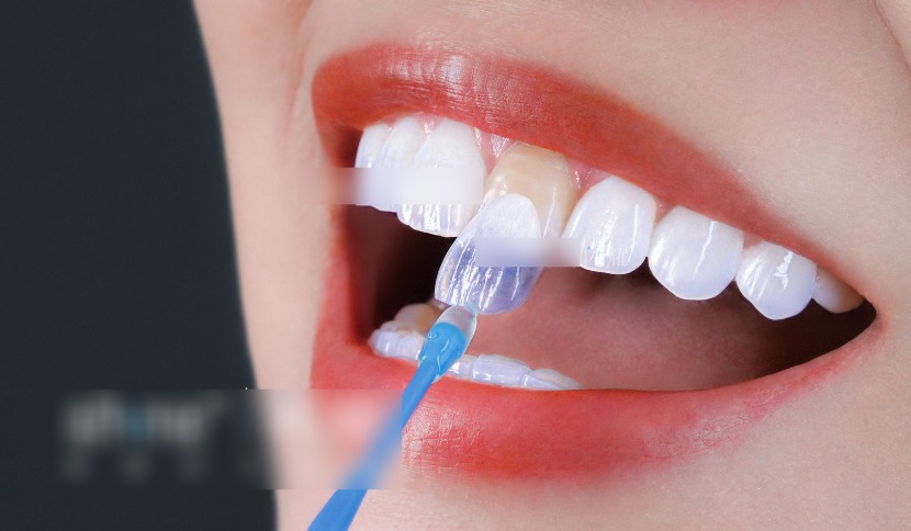 鹽城倍美口腔的正規(guī)性如何？