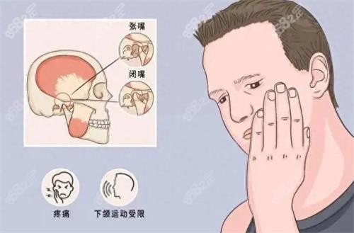 咬合不對的狀態(tài)