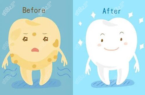 牙齒美白前后示意圖