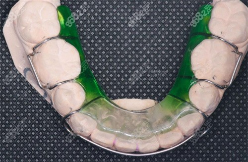 保持器實(shí)拍 保持器實(shí)拍