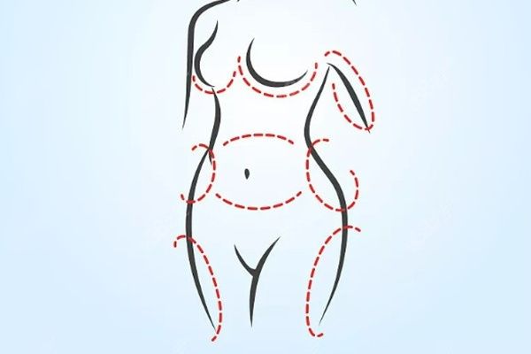 重慶羅海軍和章小平哪個醫(yī)生做吸脂手術(shù)效果好？技術(shù)亮點(diǎn)及坐診醫(yī)院大比拼