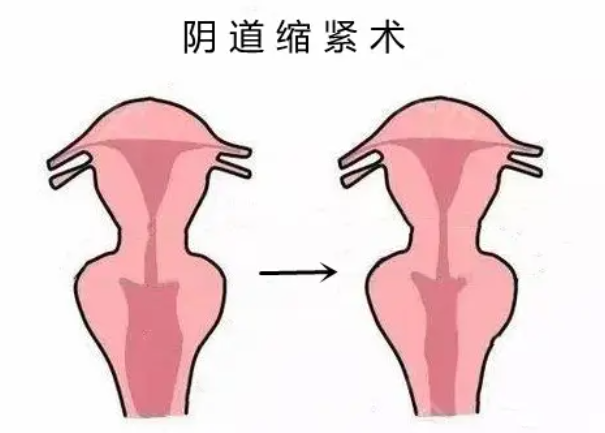 銀川緊縮手術(shù)醫(yī)院推薦概覽