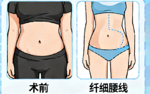 南寧芭芘麗整形