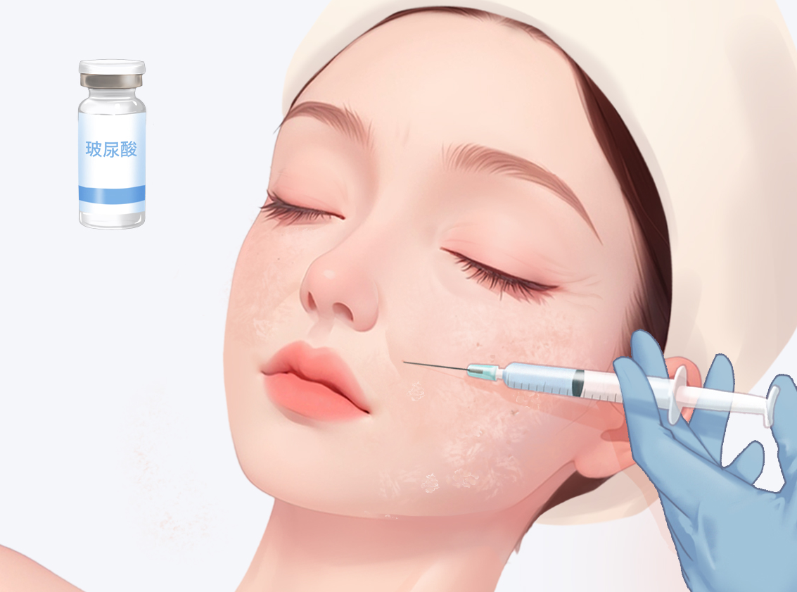 李方奇和王闊遠(yuǎn)誰(shuí)的口碑好