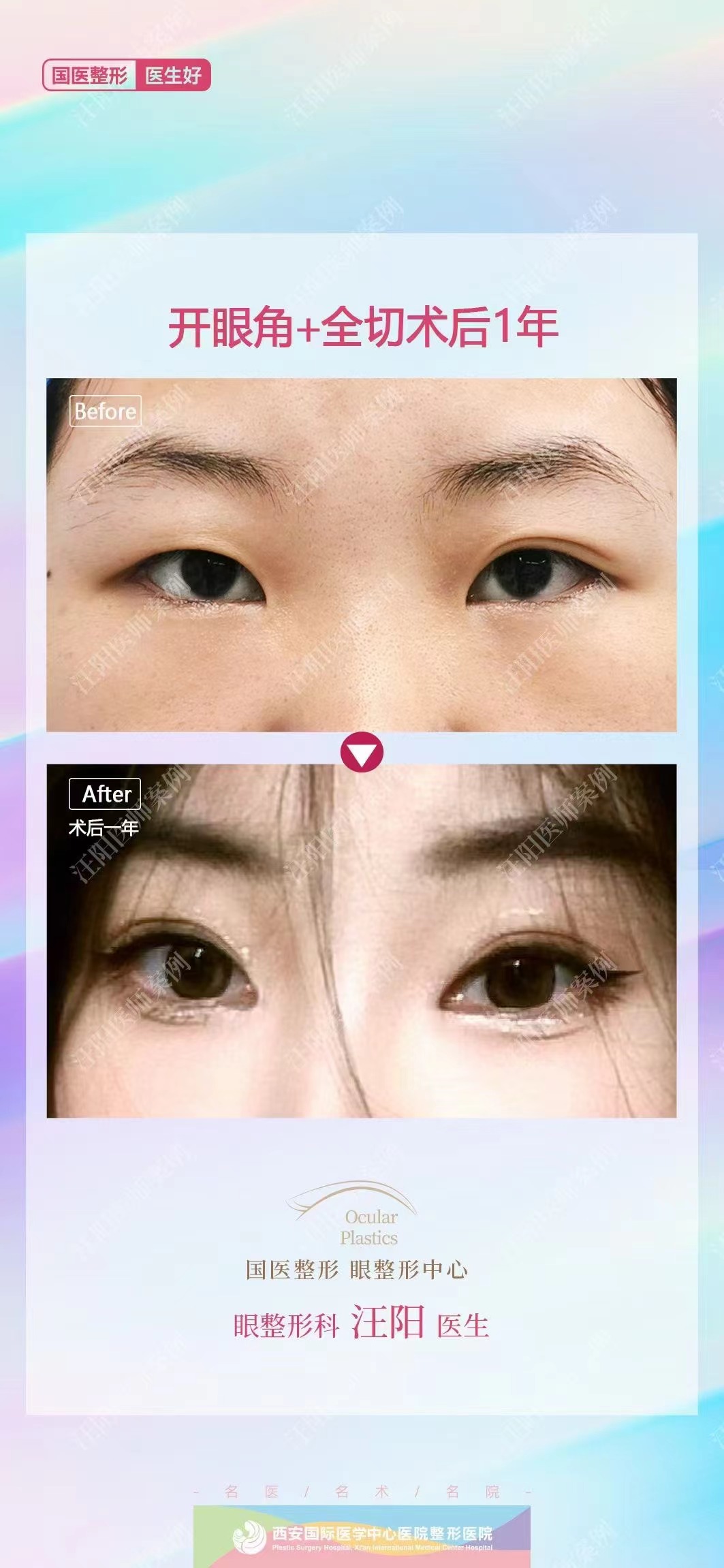 深圳哪家國有醫(yī)院做嘴巴整形好？北京大學深圳醫(yī)院的嘴巴整形服務(wù)優(yōu)勢