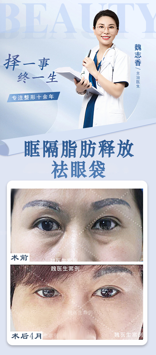 3. 北京打瘦臉針多少錢——按品牌區(qū)分：國(guó)產(chǎn)vs進(jìn)口價(jià)格差異明顯