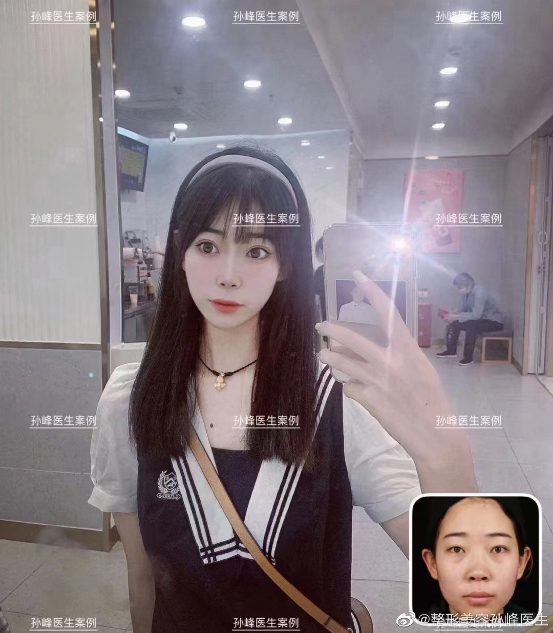 西安十大疤痕修復醫(yī)院排名公布的西安有名疤痕修復醫(yī)院名單前半段——西安友誼醫(yī)院醫(yī)學整形科