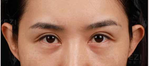 西安十大疤痕修復醫(yī)院排名公布的西安有名疤痕修復醫(yī)院名單前半段——西安第九醫(yī)院皮膚整形科