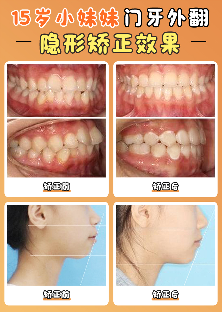 患者對焦作植得口腔醫(yī)院的評價(jià)怎樣？www.66ub.cn