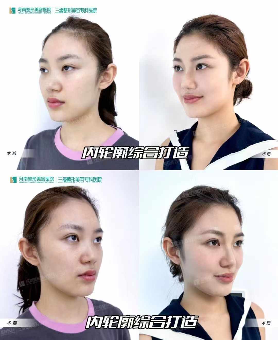 結(jié)尾：于艷菊坐診醫(yī)院總結(jié)，找對(duì)陣地才能精細(xì)修復(fù)www.66ub.cn