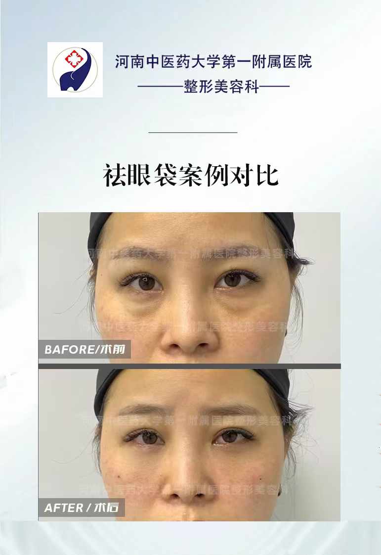 二、于艷菊坐診鄭州枝蔓醫(yī)療美容診所：主陣地的“疤痕修復(fù)核心”