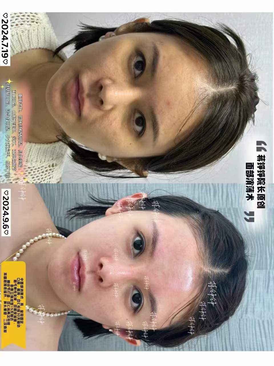 手術會不會有風險，成都素美存在哪些負面情況？