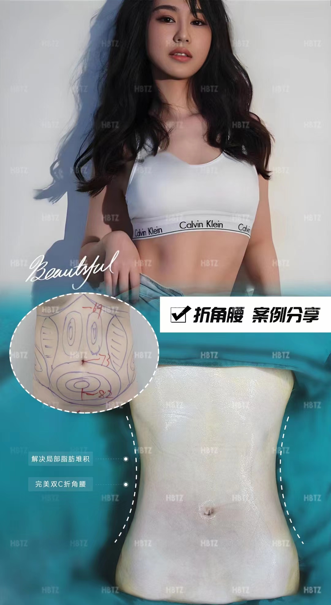 成都素美李建鋼醫(yī)生無痕筋膜提升價格究竟如何？