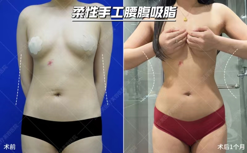 廣州華美醫(yī)院，抗衰美膚有妙招？