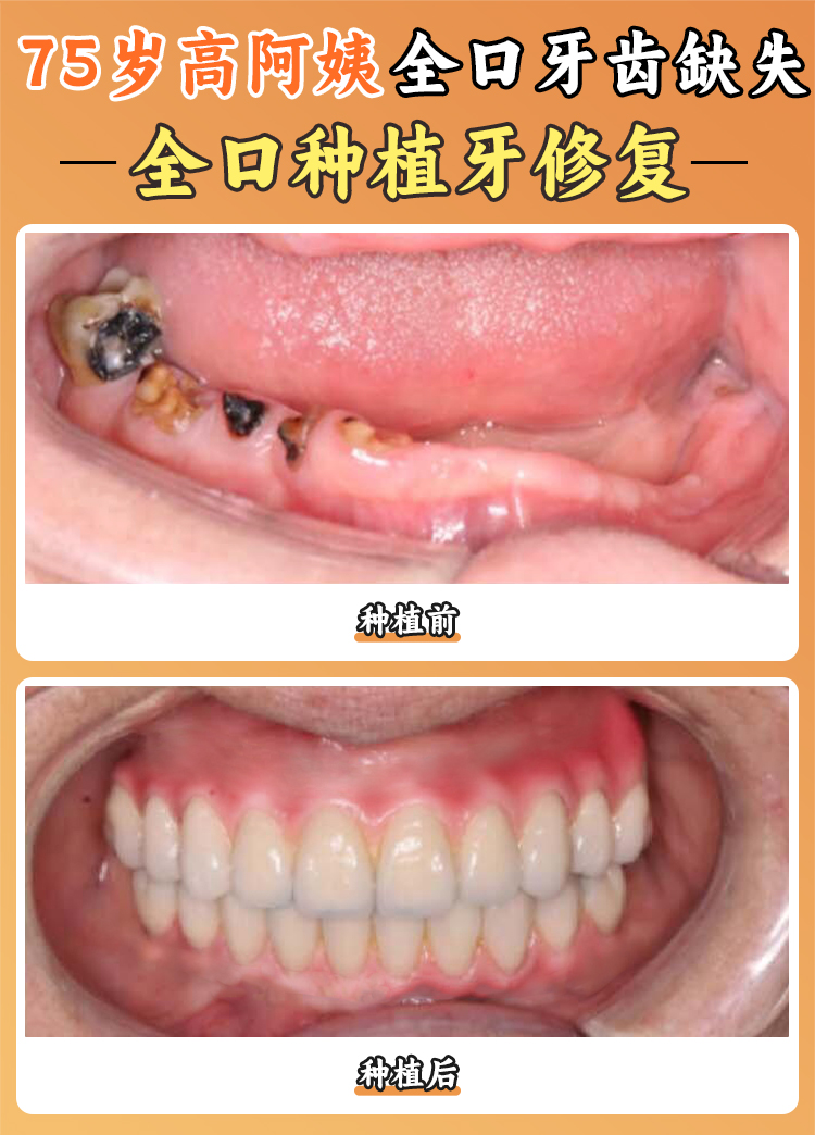 焦作植得口腔的收費(fèi)合理嗎？
