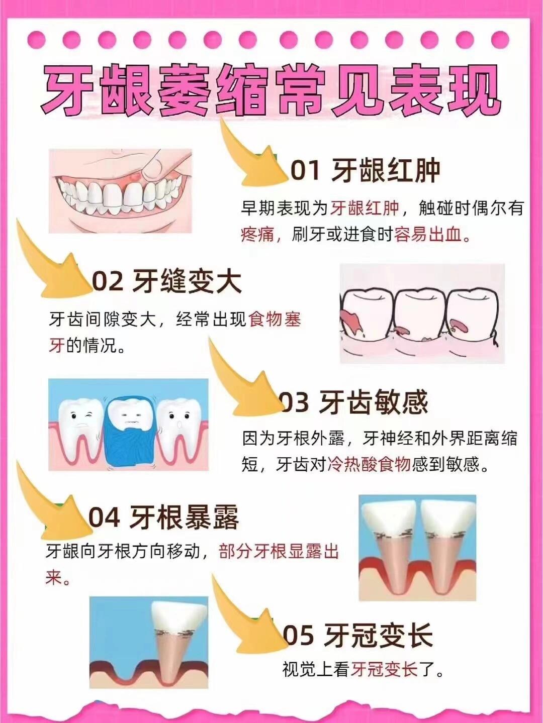 金屬托槽矯正的原理和特點(diǎn)是什么？