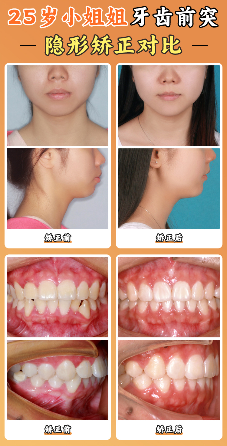 西安新城區(qū)能刷醫(yī)療保險的牙科——牙一生口腔
