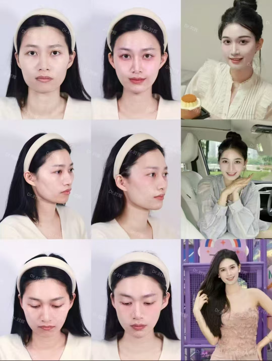 八大處拉皮手術(shù)誰(shuí)做的好？王千文、趙延勇、侯典舉等醫(yī)生技術(shù)優(yōu)勢(shì)大揭秘！ 