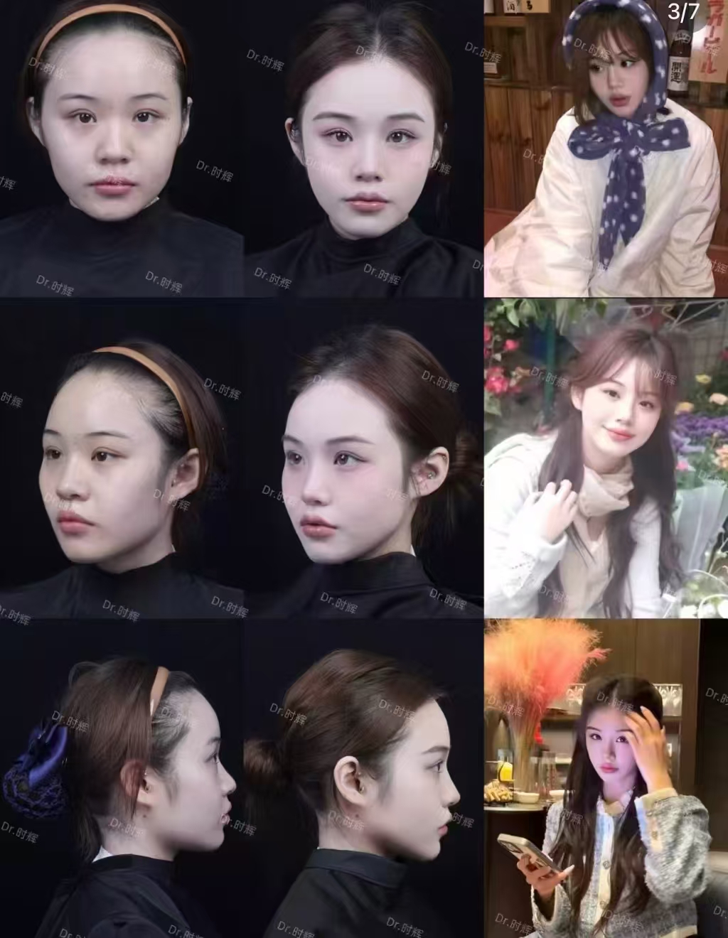 四、用戶口碑見證八大處拉皮手術(shù)實(shí)力