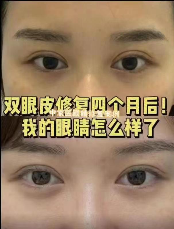 蘭溪華博仕口腔怎么樣？正規(guī)資質(zhì)、經(jīng)驗(yàn)醫(yī)生、透明價(jià)格，滿意度超90%值得選！ 