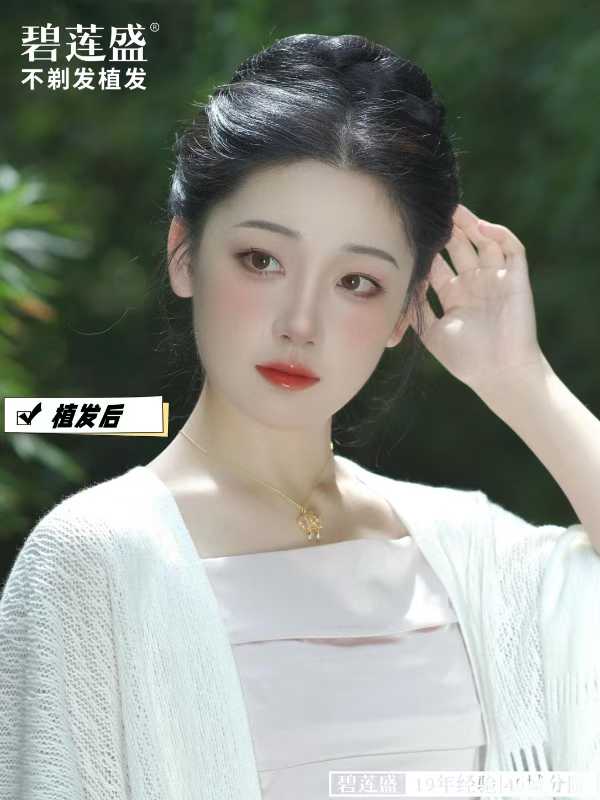 二、不同植發(fā)技術(shù)下的價格對比