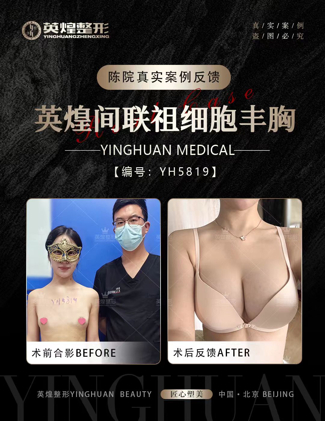 美波婷豐胸材料引發(fā)的醫(yī)院相關(guān)危害