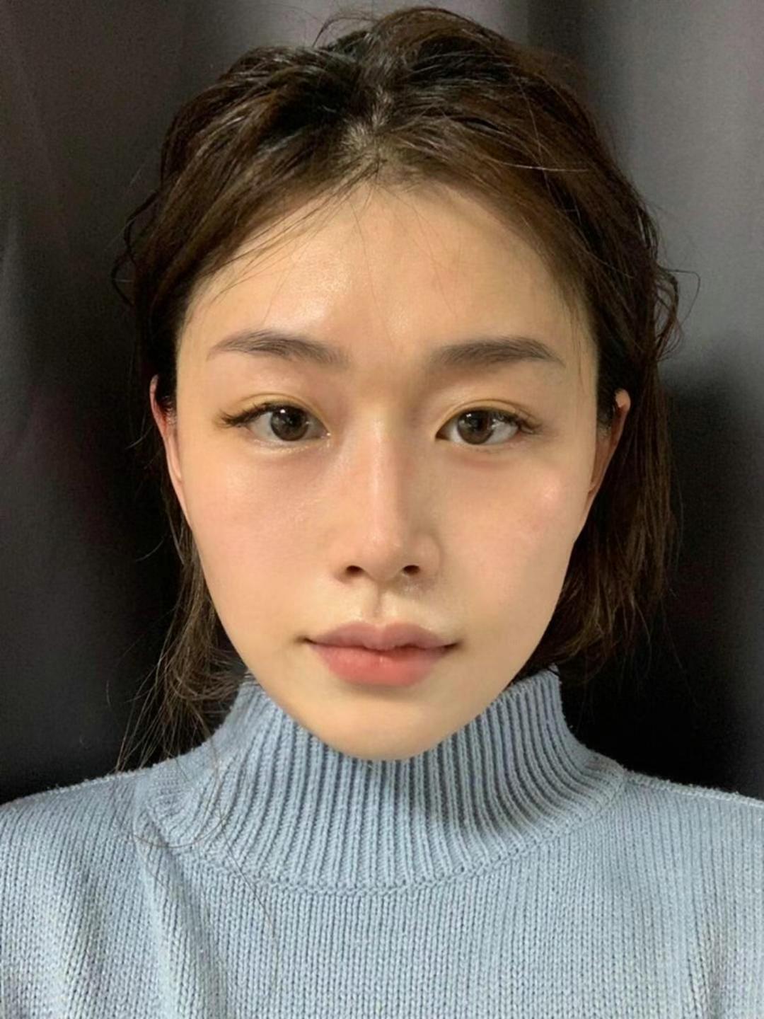 如何選擇合適的機(jī)構(gòu)進(jìn)行李建鋼筋膜提升？www.66ub.cn