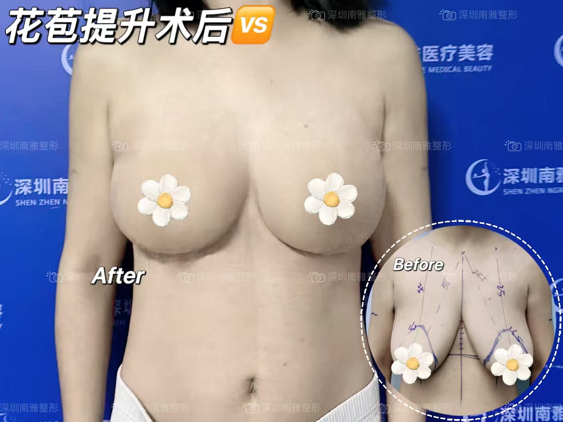 一、深圳蒙恩口腔是幾級(jí)醫(yī)院啊——醫(yī)院等級(jí)評(píng)定情況