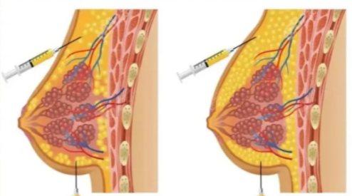 2025年內(nèi)江啟辰口腔牙齒矯正收費價目表
