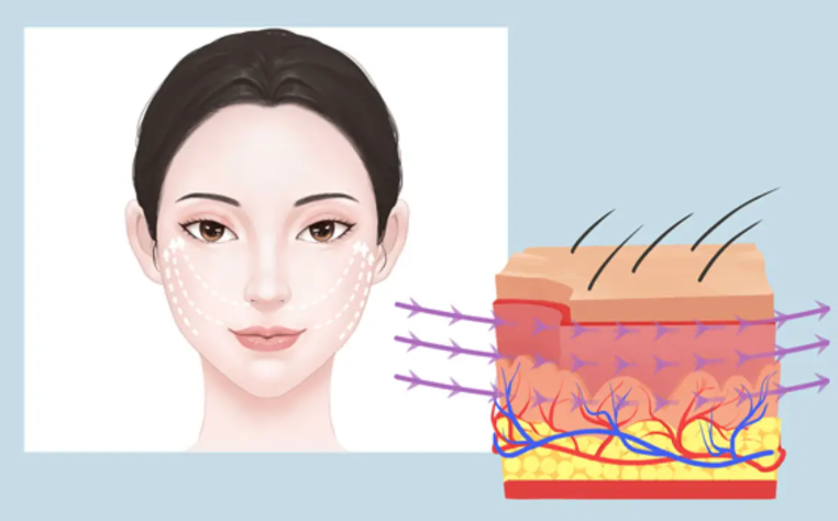 聶云飛做不做面部線雕手術(shù)www.66ub.cn