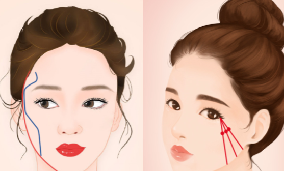  楊君毅醫(yī)生做顴弓內(nèi)推嗎www.66ub.cn