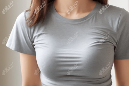 隆胸手術(shù)圖片 隆胸手術(shù)圖片