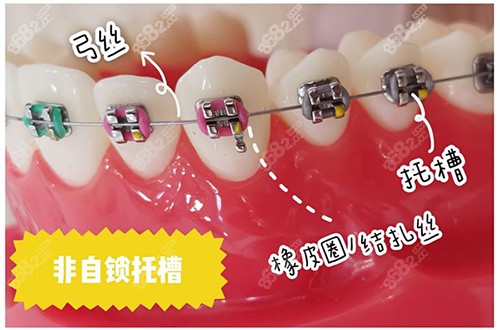 西安牙齒矯正哪個醫(yī)院好？2026西安牙齒矯正好評榜前十的牙科診所分享